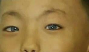 طفل بعيون قط يحير الأطباء في الصين